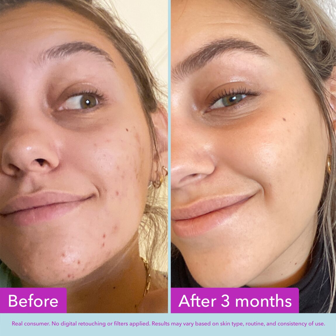 niacinamide-brightening-toner-f1 zb_p.jpg